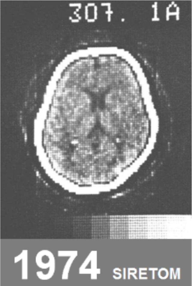 Brain scan image circa 1974, presented by siemens