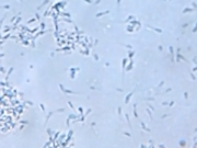 WATCH | Sperm count falling sharply in developed world — researchers