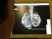 Family history increases breast cancer risk even for older women