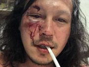 Baron Geisler nabbed for alarm and scandal in Angeles