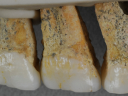 Homo luzonesis teeth