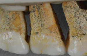 Homo luzonesis teeth