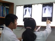 Chinese doctor's lungs
