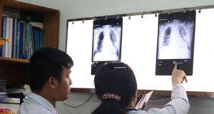 Chinese doctor's lungs