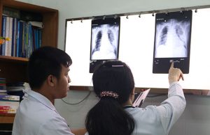 Chinese doctor's lungs