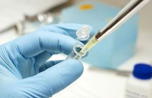 File photo of laboratory testing