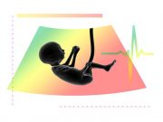 Placenta may have mechanism that protects fetus from COVID; vaccines safe with rheumatic diseases