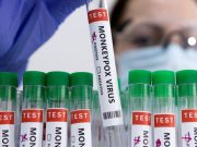 WHO plans to rename monkeypox to ‘MPOX’ —Politico