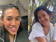 ‘I am obsessed’: Pinay featured in foreign media for having ‘bunny teeth’ done Ulya Hagedorn