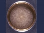 Global deaths from fungal disease have doubled in a decade – new study