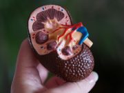 ‘Kidney Patrol’: This CKD online test helps Pinoys find if they’re at risk for kidney disease