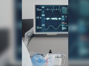 Ethical concerns: NPC flags viral ‘flatline’ video taken by nursing student Heart monitor