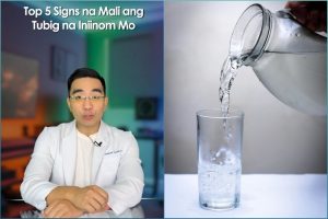 5 telltale signs of dehydration to watch out for, according to Dr. Kilimanguru