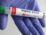 Philippines says recent mpox case is mild Clade 2 variant