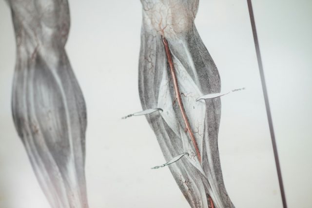 muscle-illustration