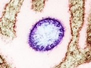 No Nipah virus cases detected in China, state media says