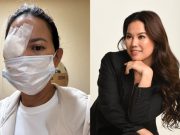 Beauty routine alert: Andrea del Rosario shares lessons after eye surgery